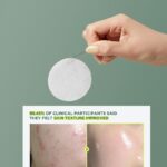 Anua Heartleaf 77 Clearpad 160ml (70EA) – Απολεπιστικά, ενυδατικά δισκία για καθημερινή χρήση